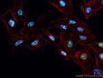 DHX37 Antibody in Immunocytochemistry (ICC/IF)