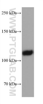 EMCN Antibody in Western Blot (WB)