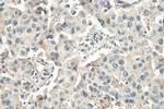 RCHY1 Antibody in Immunohistochemistry (Paraffin) (IHC (P))