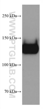 GP1BA Antibody in Western Blot (WB)