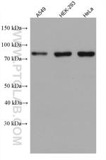 GIT2 Antibody in Western Blot (WB)