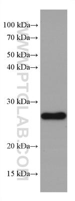 GSTM1 Antibody in Western Blot (WB)