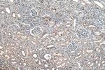 HSP47 Antibody in Immunohistochemistry (Paraffin) (IHC (P))