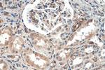 HSP47 Antibody in Immunohistochemistry (Paraffin) (IHC (P))