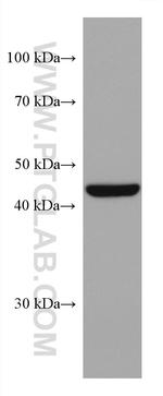 HSP47 Antibody in Western Blot (WB)
