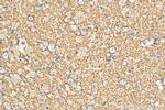 Synaptophysin Antibody in Immunohistochemistry (Paraffin) (IHC (P))