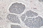 CSNK2B Antibody in Immunohistochemistry (Paraffin) (IHC (P))