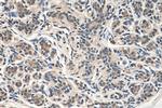 CSNK2B Antibody in Immunohistochemistry (Paraffin) (IHC (P))