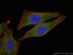 GEMIN8 Antibody in Immunocytochemistry (ICC/IF)