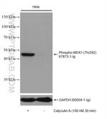 Phospho-MEK1 (Thr292) Antibody in Western Blot (WB)