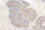 DAXX Antibody in Immunohistochemistry (Paraffin) (IHC (P))