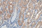 LPCAT3 Antibody in Immunohistochemistry (Paraffin) (IHC (P))