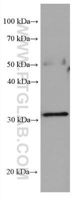 Stomatin Antibody in Western Blot (WB)