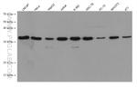 SLC25A36 Antibody in Western Blot (WB)
