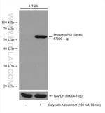 Phospho-P53 (Ser46) Antibody in Western Blot (WB)