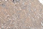 EIF5A2 Antibody in Immunohistochemistry (Paraffin) (IHC (P))