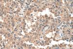 EIF5A2 Antibody in Immunohistochemistry (Paraffin) (IHC (P))