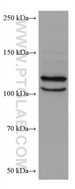 OSBPL5 Antibody in Western Blot (WB)