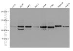 OSBPL5 Antibody in Western Blot (WB)