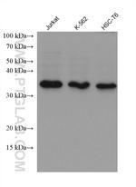 NUDT22 Antibody in Western Blot (WB)