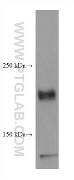 ROBO1 Antibody in Western Blot (WB)