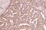 TRAPA/SSR1 Antibody in Immunohistochemistry (Paraffin) (IHC (P))