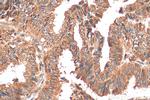TRAPA/SSR1 Antibody in Immunohistochemistry (Paraffin) (IHC (P))