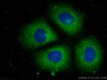 PSME1 Antibody in Immunocytochemistry (ICC/IF)