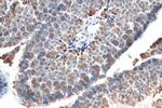 SLC36A3 Antibody in Immunohistochemistry (Paraffin) (IHC (P))