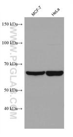 PTPN9 Antibody in Western Blot (WB)