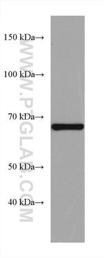 PTPN9 Antibody in Western Blot (WB)