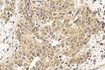 AGO2 Antibody in Immunohistochemistry (Paraffin) (IHC (P))