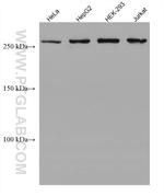 SETD1A Antibody in Western Blot (WB)