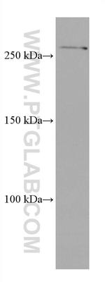 SETD1A Antibody in Western Blot (WB)