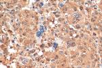 PSMA3 Antibody in Immunohistochemistry (Paraffin) (IHC (P))