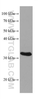 NAT1 Antibody in Western Blot (WB)