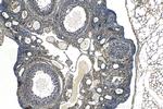 RAB14 Antibody in Immunohistochemistry (Paraffin) (IHC (P))