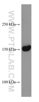 RON/MST1R Antibody in Western Blot (WB)