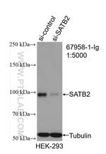 SATB2 Antibody in Western Blot (WB)