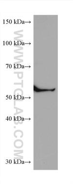 CCT6B Antibody in Western Blot (WB)