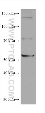 CCT6B Antibody in Western Blot (WB)