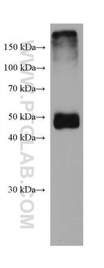 SHMT1 Antibody in Western Blot (WB)