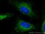 HADHB Antibody in Immunocytochemistry (ICC/IF)