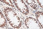 HADHB Antibody in Immunohistochemistry (Paraffin) (IHC (P))