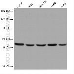 HADHB Antibody in Western Blot (WB)