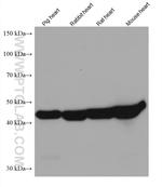 HADHB Antibody in Western Blot (WB)