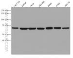 RPA1 Antibody in Western Blot (WB)