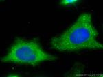 LIMK1 Antibody in Immunocytochemistry (ICC/IF)