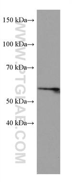 LIMK1 Antibody in Western Blot (WB)