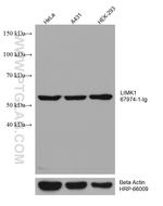 LIMK1 Antibody in Western Blot (WB)